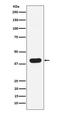 Major Histocompatibility Complex, Class I, B antibody, M00186-2, Boster Biological Technology, Western Blot image 