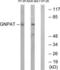 Glyceronephosphate O-Acyltransferase antibody, LS-C119905, Lifespan Biosciences, Western Blot image 
