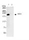 Enhancer Of MRNA Decapping 4 antibody, ab72408, Abcam, Immunoprecipitation image 