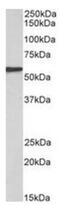 Epoxide Hydrolase 2 antibody, NBP2-44321, Novus Biologicals, Western Blot image 