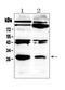 Platelet Derived Growth Factor Subunit B antibody, A00348, Boster Biological Technology, Western Blot image 