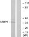 Cytosolic Thiouridylase Subunit 1 antibody, TA315968, Origene, Western Blot image 