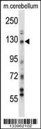 Ubiquitin carboxyl-terminal hydrolase 15 antibody, 57-667, ProSci, Western Blot image 