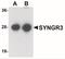 Synaptogyrin 3 antibody, NBP1-77102, Novus Biologicals, Western Blot image 