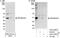 Zinc Finger RANBP2-Type Containing 2 antibody, A301-029A, Bethyl Labs, Immunoprecipitation image 