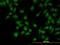 CDC Like Kinase 3 antibody, H00001198-M04, Novus Biologicals, Immunocytochemistry image 