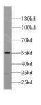 Sperm Associated Antigen 4 antibody, FNab08142, FineTest, Western Blot image 