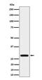 Penta-EF-Hand Domain Containing 1 antibody, M09591, Boster Biological Technology, Western Blot image 