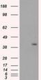 Protein phosphatase 1 regulatory subunit 7 antibody, NBP1-47924, Novus Biologicals, Western Blot image 