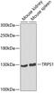 Transcriptional Repressor GATA Binding 1 antibody, 23-148, ProSci, Western Blot image 