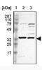 Solute Carrier Family 25 Member 21 antibody, NBP1-82493, Novus Biologicals, Western Blot image 
