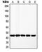 Mitogen-Activated Protein Kinase Kinase 1 antibody, LS-C352744, Lifespan Biosciences, Western Blot image 