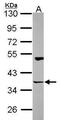 Homer Scaffold Protein 3 antibody, PA5-22382, Invitrogen Antibodies, Western Blot image 