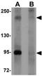 Pappalysin 2 antibody, GTX85150, GeneTex, Western Blot image 