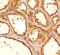 Thyroglobulin antibody, 33-210, ProSci, Western Blot image 
