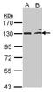 Mitogen-Activated Protein Kinase Kinase Kinase 14 antibody, PA5-27713, Invitrogen Antibodies, Western Blot image 