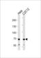 Succinate dehydrogenase [ubiquinone] flavoprotein subunit, mitochondrial antibody, LS-C204024, Lifespan Biosciences, Western Blot image 