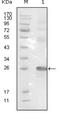 EPH Receptor B3 antibody, NBP1-47522, Novus Biologicals, Western Blot image 