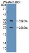 DNA Topoisomerase II Binding Protein 1 antibody, LS-C712761, Lifespan Biosciences, Western Blot image 