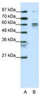 General Transcription Factor IIF Subunit 1 antibody, TA330080, Origene, Western Blot image 
