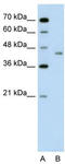 LRP2 Binding Protein antibody, TA344154, Origene, Western Blot image 