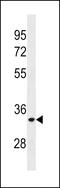 ELOVL Fatty Acid Elongase 3 antibody, 60-758, ProSci, Western Blot image 