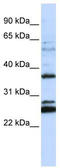 Transmembrane Protein 255A antibody, TA342048, Origene, Western Blot image 