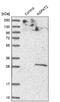 1-Acylglycerol-3-Phosphate O-Acyltransferase 2 antibody, NBP1-88499, Novus Biologicals, Western Blot image 