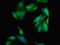 Ribosomal Protein Lateral Stalk Subunit P0 antibody, orb352265, Biorbyt, Immunocytochemistry image 