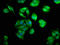Centromere Protein J antibody, LS-C673936, Lifespan Biosciences, Immunofluorescence image 