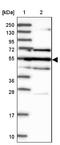 Galactose-3-O-Sulfotransferase 4 antibody, NBP1-82309, Novus Biologicals, Western Blot image 