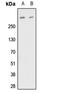 Fibrillin 1 antibody, LS-C358981, Lifespan Biosciences, Western Blot image 