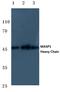 Mannan Binding Lectin Serine Peptidase 1 antibody, PA5-37428, Invitrogen Antibodies, Western Blot image 