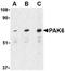 Serine/threonine-protein kinase PAK 6 antibody, TA306114, Origene, Western Blot image 