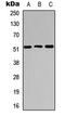 Cathepsin C antibody, LS-C354303, Lifespan Biosciences, Western Blot image 