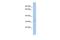 Translocase Of Outer Mitochondrial Membrane 40 Like antibody, PA5-68687, Invitrogen Antibodies, Western Blot image 