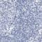 SLIT-ROBO Rho GTPase Activating Protein 3 antibody, NBP1-88831, Novus Biologicals, Immunohistochemistry paraffin image 