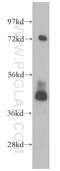 Phosphorylase Kinase Catalytic Subunit Gamma 2 antibody, 15109-1-AP, Proteintech Group, Western Blot image 