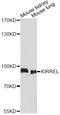 Kirre Like Nephrin Family Adhesion Molecule 1 antibody, A32447, Boster Biological Technology, Western Blot image 