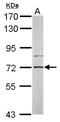 Phosphatidylinositol-4-phosphate 5-kinase type-1 gamma antibody, NBP1-32408, Novus Biologicals, Western Blot image 