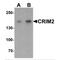 Kielin Cysteine Rich BMP Regulator antibody, MBS150290, MyBioSource, Western Blot image 