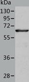 Delta-1-pyrroline-5-carboxylate dehydrogenase, mitochondrial antibody, TA323996, Origene, Western Blot image 