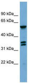 G Protein-Coupled Receptor Kinase 4 antibody, TA336190, Origene, Western Blot image 