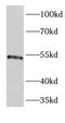 Erythropoietin Receptor antibody, FNab02816, FineTest, Western Blot image 