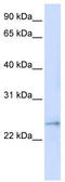 Family With Sequence Similarity 156 Member B antibody, TA343801, Origene, Western Blot image 