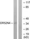 Olfactory Receptor Family 52 Subfamily N Member 4 (Gene/Pseudogene) antibody, TA316412, Origene, Western Blot image 