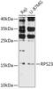 40S ribosomal protein S23 antibody, 16-972, ProSci, Western Blot image 