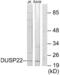 Dual Specificity Phosphatase 22 antibody, abx013808, Abbexa, Western Blot image 