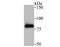 Phosphofructokinase, Muscle antibody, A04370-2, Boster Biological Technology, Western Blot image 