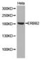 CD207 Molecule antibody, LS-C193050, Lifespan Biosciences, Western Blot image 